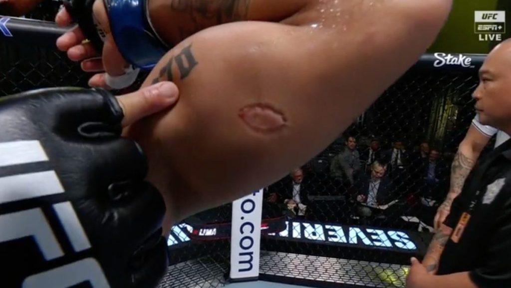 , 202403UFC bite fight e1711243259885