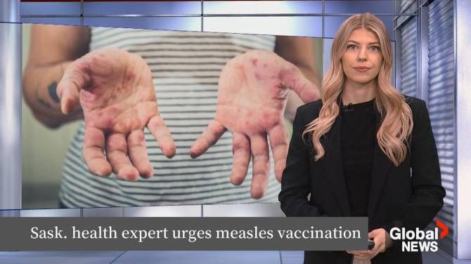 Click to play video: Measles immunization rates high as out-of-province cases pop up