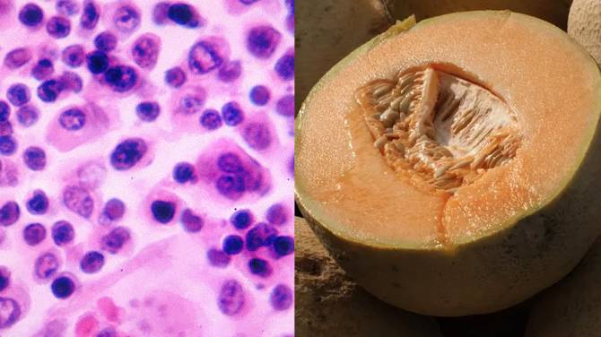 Click to play video: What salmonella symptoms to watch out for as cantaloupe-linked outbreak kills 5 in Canada