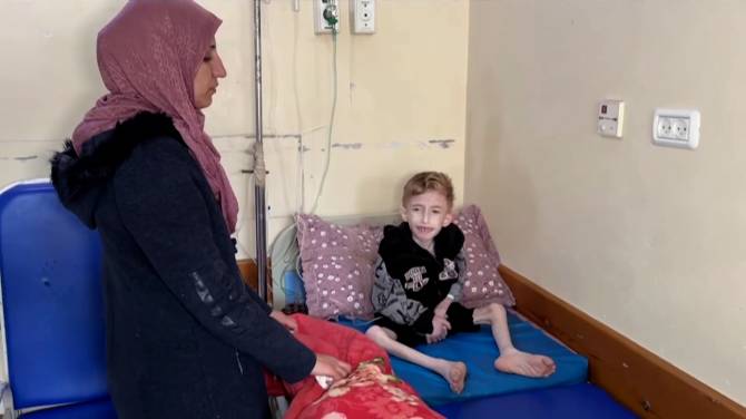 Click to play video: Children in Gaza dying from ‘malnutrition and disease’: WHO