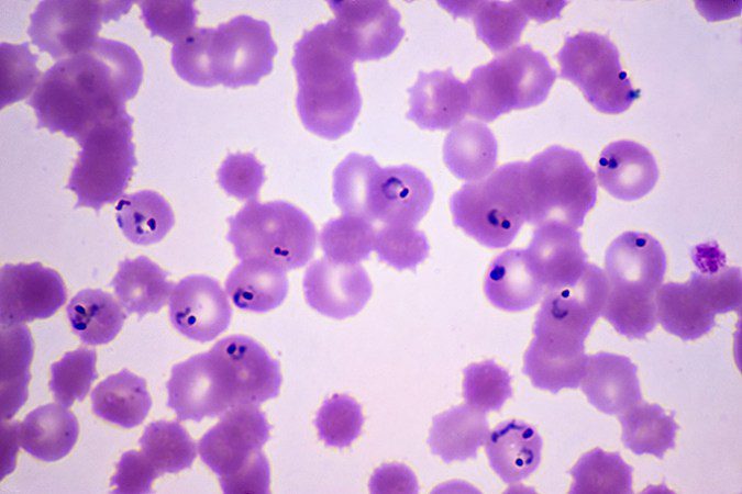 A microscope image of human red blood cells infected by malaria parasites. The parasites look like dark purple rings on the pink-stained blood cells.